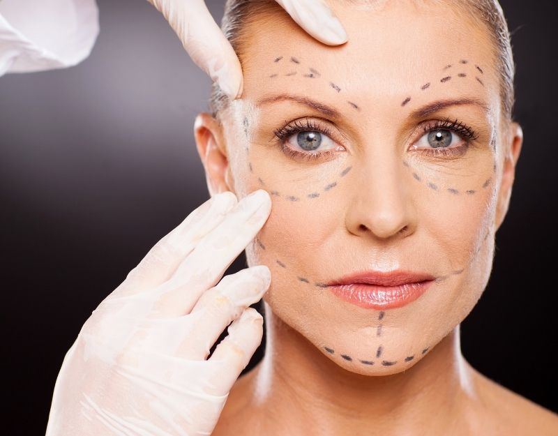 Non-Surgical Facelift Prosedürü